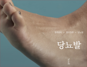 당뇨 초기증상 발저림·발냄새·상처가 낫지 않을 때 확인할 신호