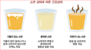 당뇨 초기증상 소변, 다뇨·야뇨·거품뇨로 확인해야 할 신호