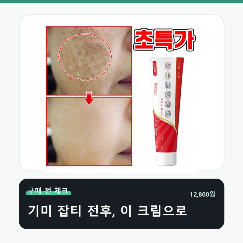 피부과 기미 잡티 제거 크림1위 착색크림 크림 화장대에 남을 조건