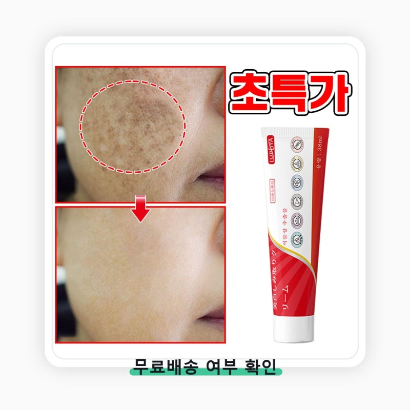 피부과 기미 잡티 제거 크림1위 착색크림 크림 화장대에 남을 조건