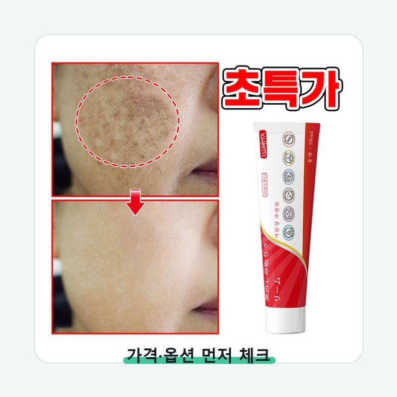 피부과 기미 잡티 제거 크림1위 착색크림 크림 화장대에 남을 조건