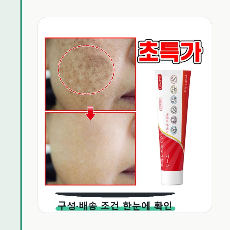 피부과 기미 잡티 제거 크림1위 착색크림 크림 화장대에 남을 조건