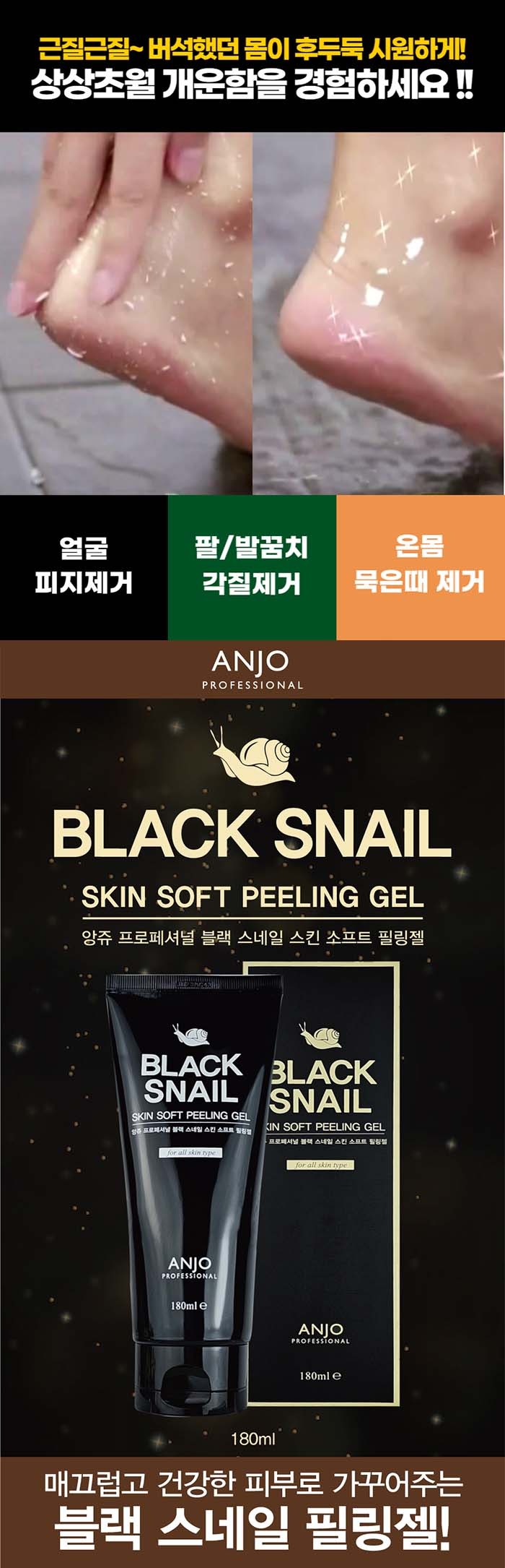앙쥬 블랙스네일 각질싹 필링젤, 대용량 3개 묶음 샀다가 후회했을까요? 5